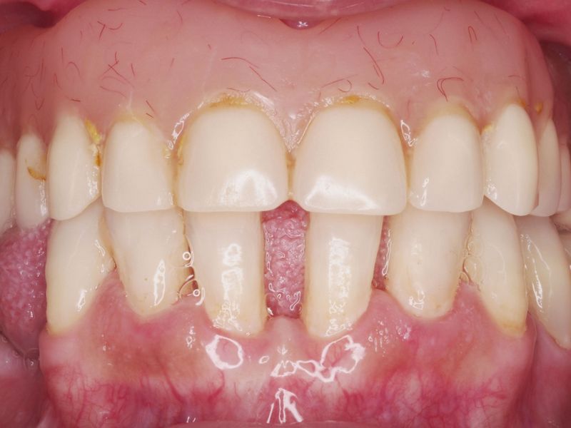 Antes y despues clínica dental