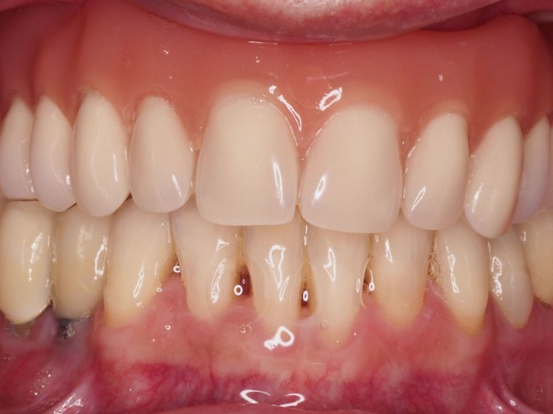 Antes y despues clínica dental
