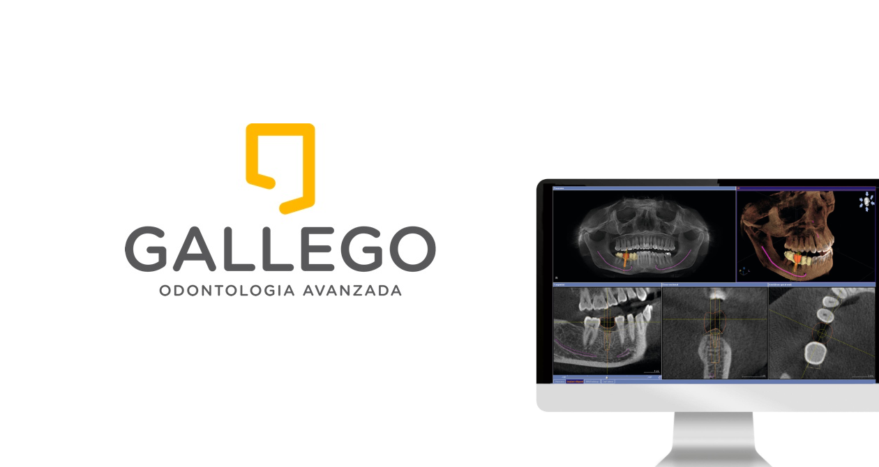 Radiografia dental completa